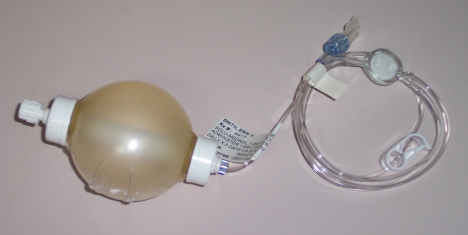 Picture of the Solu-Medrol IV Bag